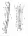 Fig. 02 - Heat sink coupling using flexible heat pipes for multi-surface components
