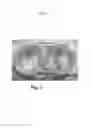 Fig. 04 - A METAL ACCUMULATION INHIBITING AND PERFORMANCE ENHANCING SUPPLEMENT AND A SYSTEM FOR DELIVERING THE SUPPLEMENT