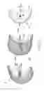 Fig. 30 - Antenna apparatus for use in wireless devices