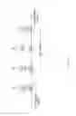 Fig. 03 - TRANSMISSION DEVICE AND METHOD FOR ESTABLISHING PATH IN MULTILAYER NETWORK