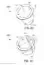 Fig. 04 - Systems and methods for mounting the printed wiring assembly to the header assembly of a pressure sensor