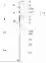 Fig. 02 - FetchPro an adjustable dog toy gripping and throwing device
