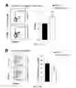 Fig. 05 - COMPOSITIONS AND METHODS FOR THE STUDY AND TREATMENT OF ACUTE KIDNEY INJURY