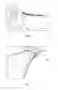 Fig. 04 - Breathable or Convertible Sleeve System