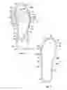 Fig. 03 - Article of footwear with a midsole assembly having a perimeter bladder element, a method of manufacturing and a mold assembly for same