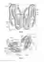 Fig. 11 - Article of footwear with a midsole assembly having a perimeter bladder element, a method of manufacturing and a mold assembly for same