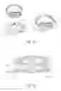 Fig. 48 - Integrated closure device components and methods