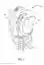 Fig. 02 - Child carrier
