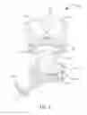 Fig. 04 - Child carrier
