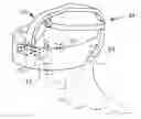 Fig. 01 - LAPAROSCOPIC VIEWING SYSTEM