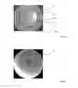 Fig. 03 - Method for realizing ocular fundus photographs that are corrected for scattered light
