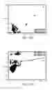 Fig. 12 - Medical device for detecting a ventricular arrhythmia event