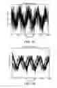 Fig. 07 - Sensor system and process for measuring electric activity of the brain, including electric field encephalography