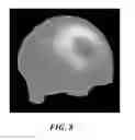 Fig. 08 - Sensor system and process for measuring electric activity of the brain, including electric field encephalography