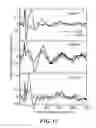 Fig. 12 - Sensor system and process for measuring electric activity of the brain, including electric field encephalography