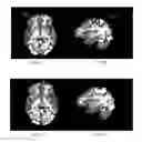 Fig. 10 - Systems and methods for providing visual feedback of touch panel input during magnetic resonance imaging