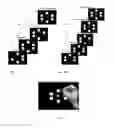 Fig. 11 - Systems and methods for providing visual feedback of touch panel input during magnetic resonance imaging