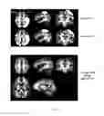 Fig. 12 - Systems and methods for providing visual feedback of touch panel input during magnetic resonance imaging