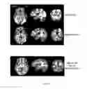 Fig. 13 - Systems and methods for providing visual feedback of touch panel input during magnetic resonance imaging