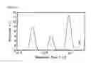 Fig. 05 - NMR sensor and methods for rapid, non-invasive determination of hydration state or vascular volume of a subject