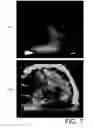 Fig. 07 - Method and device for generating image showing concentration distribution of biological substances in biological tissue