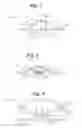 Fig. 02 - BLOOD GLUCOSE MANAGEMENT
