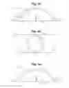 Fig. 03 - BLOOD GLUCOSE MANAGEMENT