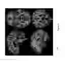 Fig. 06 - Methods and systems for quantitative brain assessment