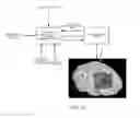 Fig. 09 - Methods, systems, and computer readable media for visualization of resection target during epilepsy surgery and for real time spatiotemporal visualization of neurophysiologic biomarkers