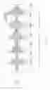 Fig. 26 - Discrimination of cheyne-stokes breathing patterns by use of oximetry signals