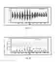 Fig. 28 - Discrimination of cheyne-stokes breathing patterns by use of oximetry signals