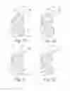 Fig. 09 - Wearable Device for the Ear with Electroencephalographic and Spectroscopic Sensors