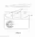 Fig. 03 - X-ray CT apparatus and gantry device