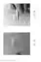 Fig. 23 - ULTRASONIC SIGNAL PROCESSING FOR BONE SONOGRAPHY