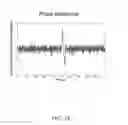 Fig. 27 - ULTRASONIC SIGNAL PROCESSING FOR BONE SONOGRAPHY