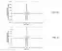 Fig. 28 - ULTRASONIC SIGNAL PROCESSING FOR BONE SONOGRAPHY
