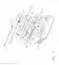 Fig. 04 - Biopsy device with integral vacuum assist and tissue sample and fluid capturing canister