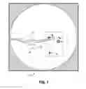 Fig. 02 - Computed tomography enhanced fluoroscopic system, device, and method of utilizing the same