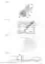 Fig. 12 - APPARATUS AND METHOD FOR SUPPORTING BIOPSY