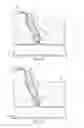 Fig. 04 - VASCULAR CLOSURE APPARATUS AND RELATED METHOD
