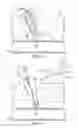 Fig. 05 - VASCULAR CLOSURE APPARATUS AND RELATED METHOD