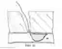 Fig. 11 - VASCULAR CLOSURE APPARATUS AND RELATED METHOD