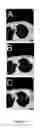 Fig. 09 - Hydrogel Pressure Sealant System