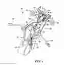 Fig. 02 - Surgical access system and related methods