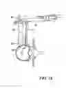Fig. 19 - Surgical access system and related methods