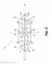 Fig. 03 - Surgical retractor system and method