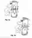 Fig. 05 - Surgical retractor system and method