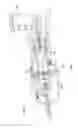 Fig. 05 - Powered surgical instrument