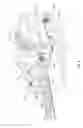 Fig. 11 - Powered surgical instrument