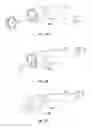 Fig. 19 - Powered surgical instrument